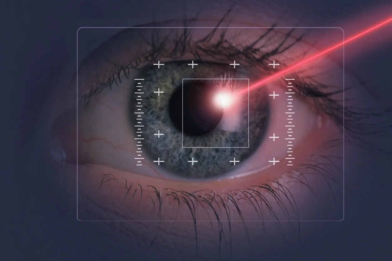 Title: LASIK vs. PRK: Choosing the Right technology.