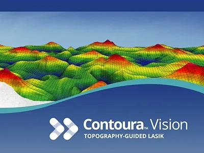 Smile vs contoura vision lasik. Which is better?