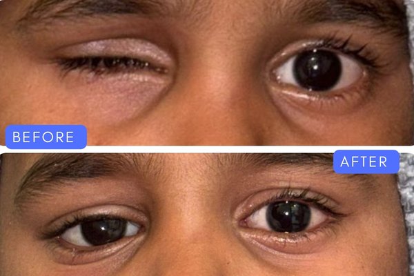 Oculoplasty & Aesthetics
